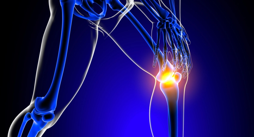 Fájdalommentes Izületek