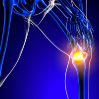 Fájdalommentes Izületek